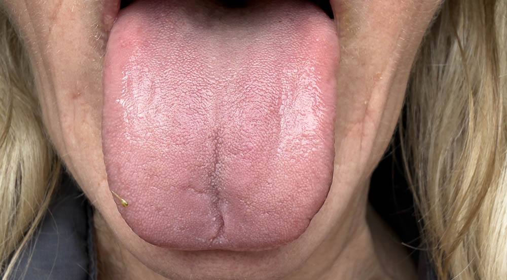 Longevity Ayurveda Retreat With Rina Golan 7 my tongue